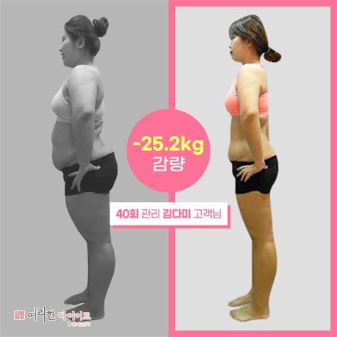 다이어트 리얼스토리 10회차 6kg감량 김다미 고객님 총 252kg 감량 성공 네이버 블로그