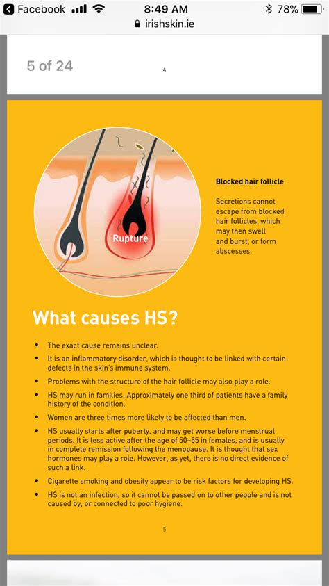 What Is Hidradenitis Suppurativa In 2020 Hidradenitis Suppurativa