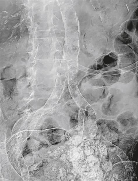 Recognizing Abnormal Calcifications and Their Causes - Clinical Tree