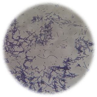 Lactobacillus Casei Gram Stain