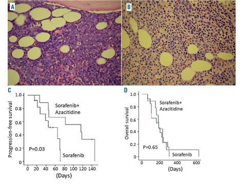 Figure 1 From Azacitidine As Post Remission Consolidation For Sorafenib