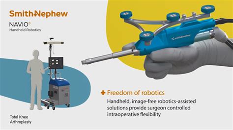 【新潟リハビリテーション病院】赤外線誘導式人工膝関節手術支援ロボットの導入－ロボット技術の応用により精度の高い手術を実現－ 株式会社nsg