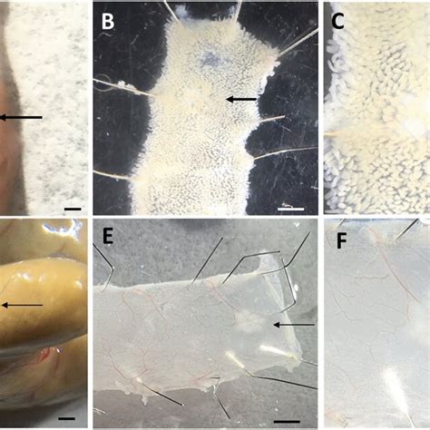 Identification Of Peyers Patches And Caecal Patch In Adult MiceAC