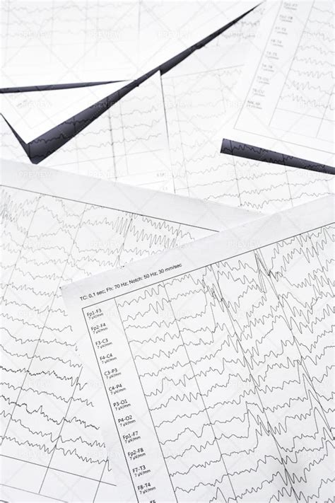 Electroencephalogram Diagnostic Rezults - Stock Photos | Motion Array