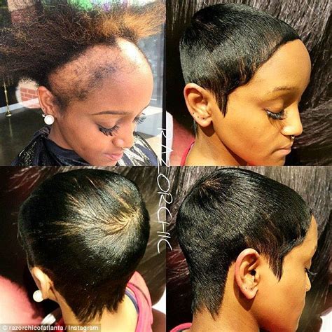 Hairstylist Warns About How Damaging Weaves Can Be Severe Hair Loss