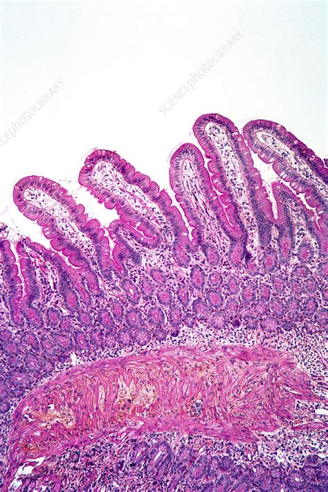 Small Intestine Light Micrograph Stock Image P520 0226 Science