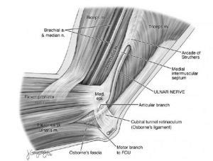 Medial Epicondylitis | Sport Med School