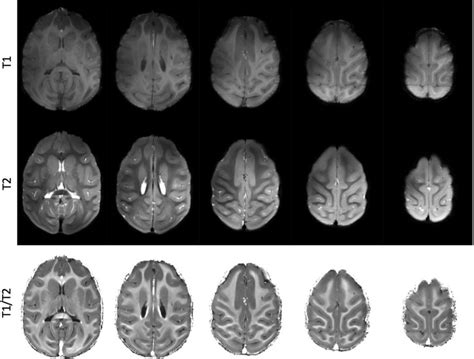 Structural Images Of The Macaque Brain Acquired At 10 5T Top Panel