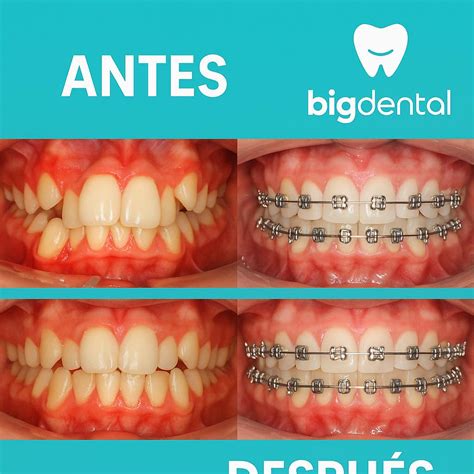 Big Dental Sorocaba - Big Dental Odontología Integral | Quito