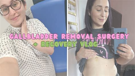 My Experience Of Gallbladder Removal Surgery The Recovery Process Postnatal Gallstones