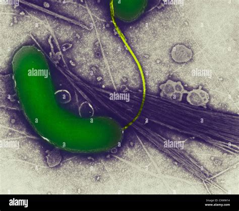 Micrografía Electrónica De La Bacteria Del Cólera Fotografía De Stock Alamy