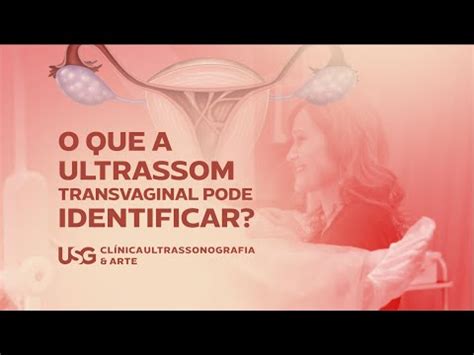 Ultrassom transvaginal o que é para que serve e quando fazer 4 видео