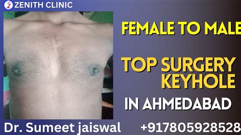 Female To Male Surgery Testimonials Ahmedabad Female To Male Gender