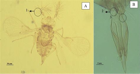 A Trichogramma Pretiosum Mounted On Hoyers Medium B Male Download Scientific Diagram