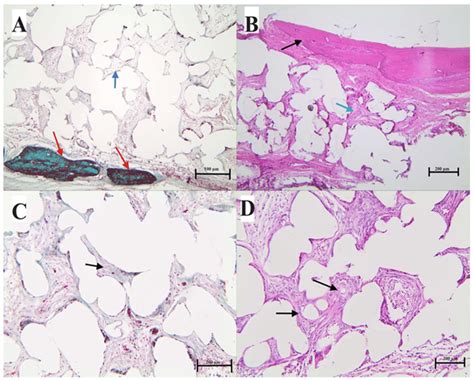 H E And Masson S Trichrome Staining For Non Coated Polyethylene Disks