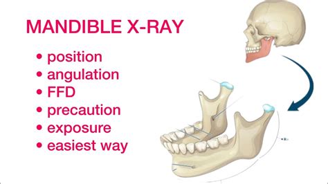 Mandible X Ray Kese Kare Easiest Way To Do Mandible X Ray Youtube