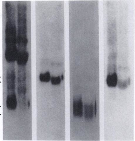 Autoradiogram Of A Northern Blot Of Mcf Rna Eren Numhered Lanes And