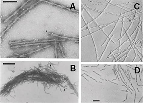 Supramolecular Organization Of Amyloid Fibrils Intechopen