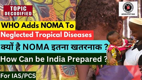 Who Adds Noma To Neglected Tropical Diseases Topic Decodified Upsc