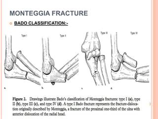 Galeazzi Fracture Classification