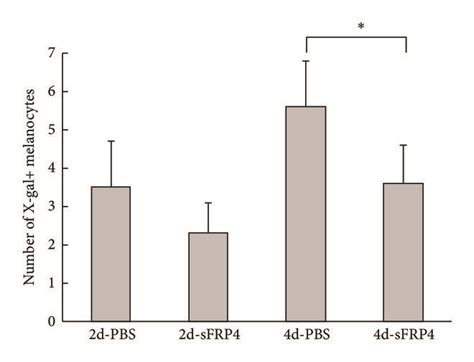 Effects Of SFRP4 On Melanocyte Differentiation In Vivo A Schematic