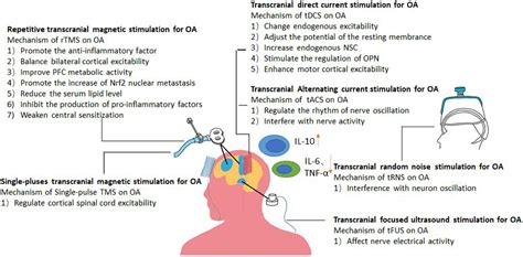 Frontiers Non Invasive Brain Stimulation For Osteoarthritis