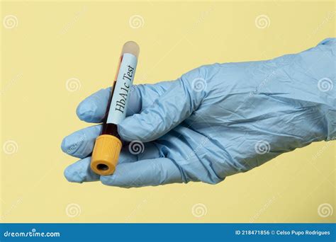 Hand With Rubber Glove Holding Vacuum Tube Of Blood To Do Hba1c