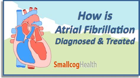 Atrial Fibrillation Diagnosed And Treated Youtube