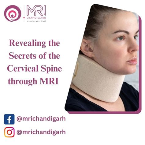 Revealing the Secrets of the Cervical Spine through MRI