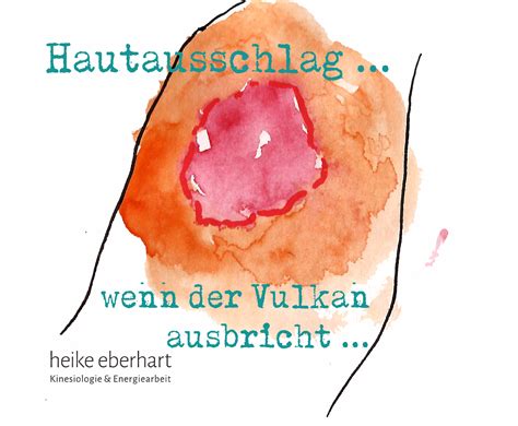 Hautausschlag Und Psyche Wenn Der Vulkan Ber Deine Haut Ausbricht