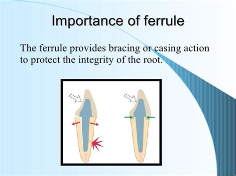 6restoration Of The Endodontically Treated Tooth