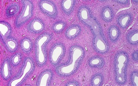 Testis Epididymis Light Micrograph Bild Kaufen 13732422 Science