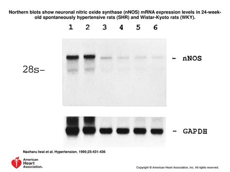 Regulation Of Neuronal Nitric Oxide Synthase In Rat Adrenal Medulla