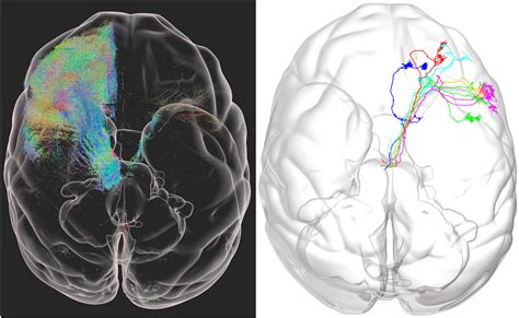 First neuron-level map of a monkey brain revealed