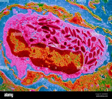 False Colour Transmission Electron Micrograph TEM Of An Eosinophil A