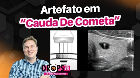 ARTEFATO EM CAUDA DE COMETA APRENDA O QUE É E COMO SURGE I VOCÊ