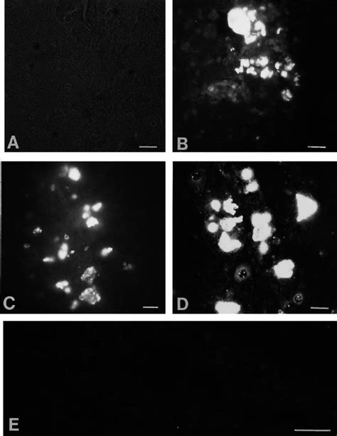 Detection Of Pv Capsid Antigen Vp1 By Immunofluorescence Labeling In