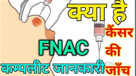 Fnac Test In Hindi Fine Needle Aspiration Cytology Test Report