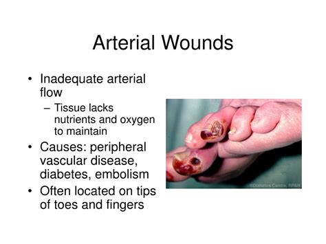 Ppt Wound Healing Physiology Powerpoint Presentation Free Download