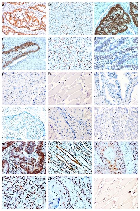 ihc staining  paraffin embedded human tissue ihc staining