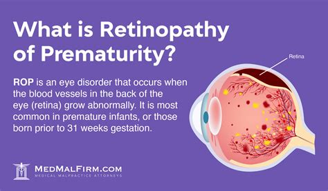 What Is Retinopathy Of Prematurity