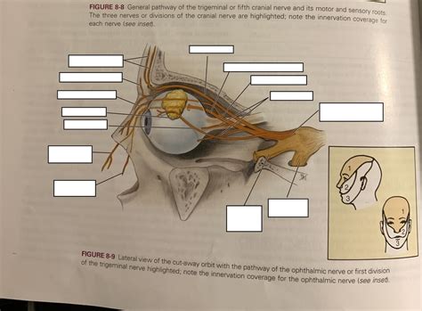 Ophthalmic Nerve Diagram Quizlet