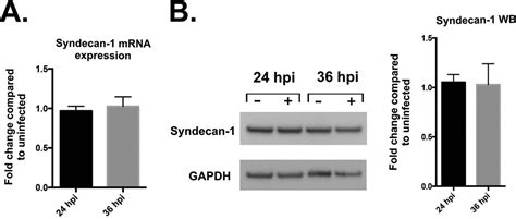 Heparanase Regulated Syndecan Shedding Facilitates Herpes Simplex