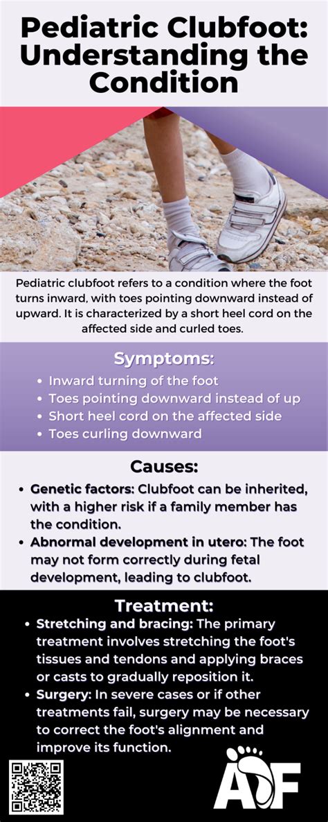 Complete Overview Of Club Foot Causes Symptoms Treatments