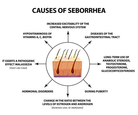 Seborrheic Dermatitis Causes: What Makes Your Skin Flare Up?