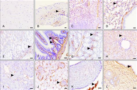 Immunohistochemical Localization Of Ninjurin In The Cerebrum A