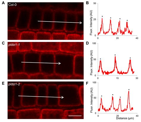 Immunolocalization Of Mitochondrial Uncoupling Protein 1 UCP1 In Root