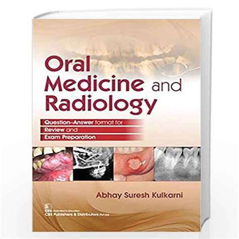 Oral Medicine And Radiology Pb 2019 By Kulkarni A S Buy Online Oral Medicine And Radiology Pb