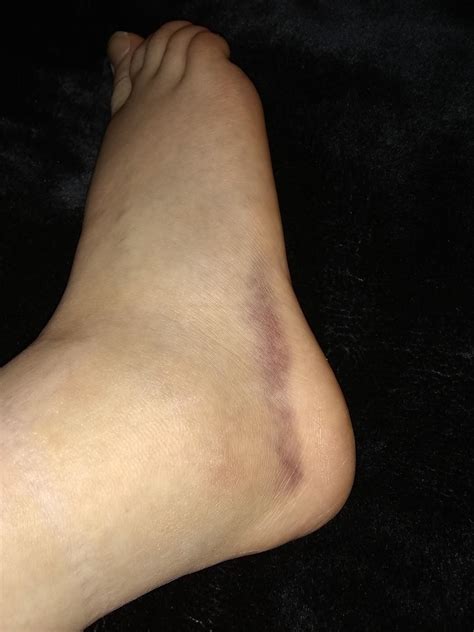 Twisted my Ankle. Got to Run the Mile Today. It's our Final. Wish me