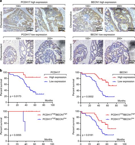 Pcdh Increases The Sensitivity Of Colorectal Cancer To Fluorouracil